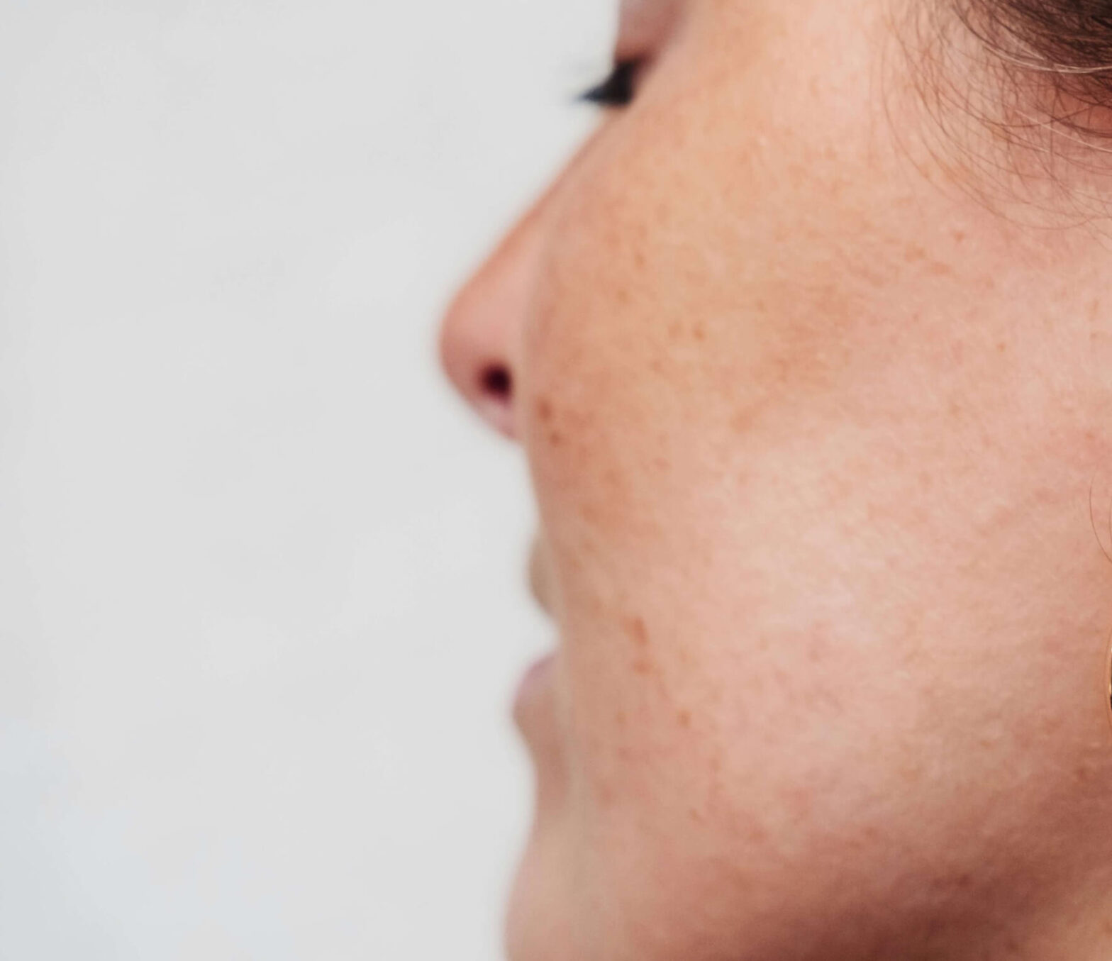 This Skin Care Routine Will Help You Beat Perimenopause Acne