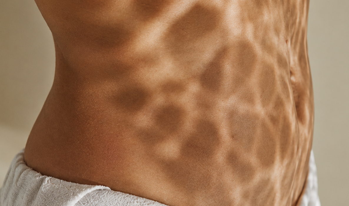The Estrogen-Gut Connection: Why Your Microbiome Matters More in Perimenopause